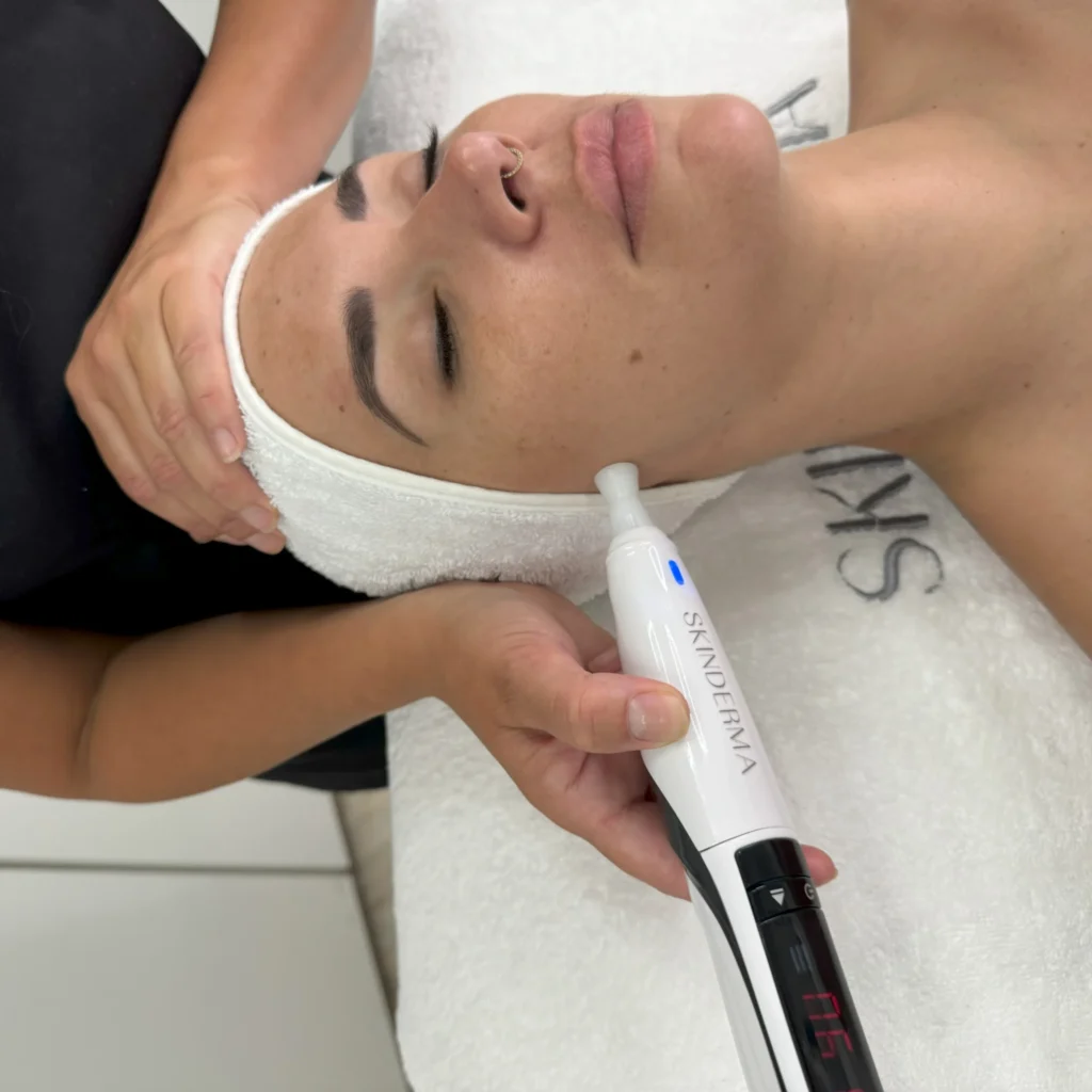SKINCURE-PlasmaDermaTech-skinderma-2-scaled