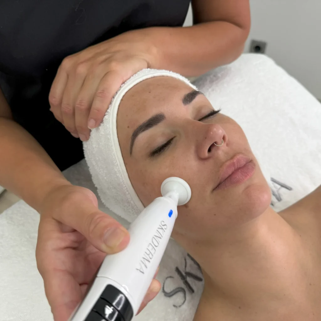 SKINCURE-PlasmaDermaTech-skinderma-6-scaled