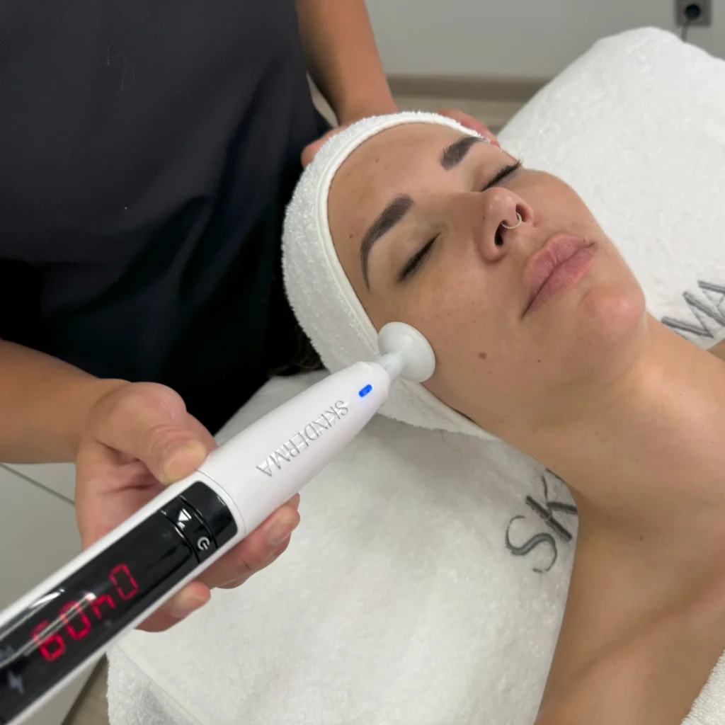SKINCURE-PlasmaDermaTech-skinderma-9-scaled